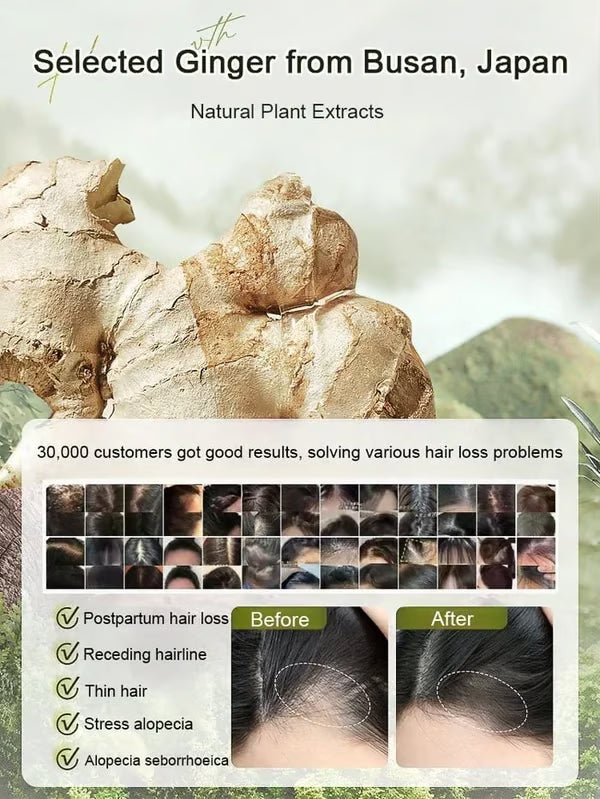 Ginger Plant Extract Anti-Hair Loss Hair Shampoo (PACK OF 4)